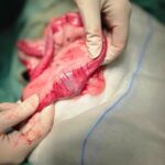 634395962_1355509576573945_7973252486235002287_n What x-rays can show us... - Kettering Vets