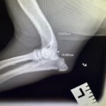 657586948_1390246623100240_1873904022044437035_n Hugo the Frenchie's Y Fracture Repair! - Kettering Vets