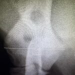 659113738_1390246633100239_4421499365271469672_n Hugo the Frenchie's Y Fracture Repair! - Kettering Vets